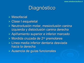 Diagnóstico Mesofacial Clase I esqueletal Neutroclusión molar, mesioclusión canina izquierda y distoclusión canina derecha Apiñamiento superior e inferior marcado Mordida cruzada de 2 os  premolares Línea media inferior dentaria desviada hacia la derecha Ausencia de guías funcionales 