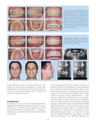 Arcos ,021”x ,025” acero superior e
                                                                        inferior para terminar de asentar las
                                                                        piezas dentarias en su lugar en los
                                                                        procesos alveolares. A posteriori, se
                                                                        utilizan arcos braided superior e
                                                                        inferior de acero multihebra del
                                                                        mismo calibre por 8 a 12 semanas y
                                                                        elásticos intermaxilares 1/8” 6 oz.,
                                                                        Se logra así el asentamiento oclusal
                                                                        y se hace la transición hacia el retiro
                                                                        de la Aparatología.




                                                                        Aparatología retirada. Contención
                                                                        superior e inferior fija, por la marca-
                                                                        da mal posición de los incisivos que
                                                                        presentaba el paciente.




Se pudieron cumplir en este paciente con                 Al ser prescripción Roth, estos brackets no
todos los objetivos planteados al inicio del             alteran la forma de trabajar de todos aquellos
tratamiento. El cambio en el perfil blando es            que utilizamos esta prescripción a diario, sim-
notorio a nivel de los labios, tras corregir las         plemente teniendo en cuenta algunas de las
mal posiciones dentarias.                                sugerencias antes mencionadas, los casos
                                                         serán resueltos más rápidamente y con
                                                         menos molestias. In-Ovation R y C no signifi-
                                                         ca tener que cambiar la forma de diagnos-
Conclusiones                                             ticar. En algunos casos al trabajar con bajas
In-Ovation R y C, son dos brackets gemelos,              cargas, puede estimular (no está demostrado
autoligantes e interactivos que junto a los arcos        científicamente) la neo formación ósea, y así
integran un sistema, el cual asegura un muy              obtener más espacio para la corrección de
bajo coeficiente de fricción arco – bracket y            apiñamientos, mediante la expansión. Pero
también un muy buen control tridimensional de            algo debe quedar claro y es que en el caso
los dientes.                                             que el material dentario sea mayor al óseo
                                                         proporcionalmente, se deberán realizar las

                                                    12
 