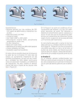 PASIVO                             EXPRESIVO                                ACTIVO


                                              Fig. 3: In-Ovation R


Características:                                            En la Figura 3 se pone en evidencia el fun-
• Bracket gemelo con clip metálico de CR-                   cionamiento del bracket y su clip con difer-
  CO, capaz de deformarse e interactuar con                 entes secciones de arcos. De izquierda a
  el arco.                                                  derecha lo encontramos pasivo, expresivo y
• Manufacturado con MIM.                                    activo. Es por eso que se los denomina inter-
• Torque en base.                                           activos por presentarse de diferentes formas
• Slot .022”x.028” o .018”x.025”.                           según el arco, la posición de la pieza dentaria
• Prescripción original Roth, actualmente                   y el momento del tratamiento.
  disponible en varias más.
• Es Bio interactivo.                                       El instrumento para abrir y cerrar el clip mas
• Base con triple malla.                                    adecuado por su utilidad y diseño es el llama-
• Identificación en base y en aleta disto gingival.         do Engage R, . Posee en uno de sus extremos
• Hooks soldados con láser.                                 una bolita para abrir el clip y en el otro un
• Acabado superficial excelente.                            pusher de arcos doble, de manera que pre-
                                                            sione el arco en mesial y distal del bracket y
En esta vista es posible observar el torque en              solamente con el dedo se pueda cerrar el clip.
la base de los In-Ovation R. Este tipo de
torque es sumamente importante en los                       In-Ovation C
brackets autoligantes, ya que una vez nivela-               Es un bracket gemelo confeccionado con
do y alineado los slots deben continuarse                   MIM con cerámica poli cristalina. Es translúci-
unos con otros bien nivelados y sin diferencia              do, esta característica le permite mimetizarse
de angulación. De esta manera el desliza-                   con el color del diente sobre el cual va adheri-
miento del arco a través de las ranuras será                do.
libre. (Figura 2)



                                                                                                    Bolita para
                                                                                                    abrir el clip




             Clip abierto                 Macro retenciones a los lados     Bisel para el retiro

                                              Fig. 4: In-Ovation C

                                                        3
 