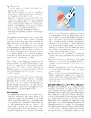 Características:
• Presenta torque en base, contorneo com-
  puesto de la misma
• Clip confeccionado en cromo cobalto y
  cubierto con Rodio, que lo hace blanqueci-
  no y opaca el brillo del metal.
• Base con macro retenciones a los lados y un
  marco en toda la periferia que se apoya
  sobre el diente impidiendo la filtración mar-
  ginal y facilitando el retiro. No tiene silano.
• Hooks redondeados en mesial y distal lo
  que hace más resistente el bracket.
• Identificación colorimétrica de Ovation.                                       Fig. 5
• Slot biselado en mesial, distal e incisal igual
  que en R.                                                 cerrado. De esta manera deberán coincidir
                                                            3 referencias con el eje longitudinal de la
Han sido recientemente lanzados al mercado,                 pieza dental, muesca de apertura, triángulo
a fines de 2007, arcos súper elásticos                      en el clip y línea vertical a incisal del brack-
Sentalloy y Bioforce, con una cubierta de                   et. El triángulo indica el sentido de apertura
rodio. Éstos al igual que los clips de In-                  del clip. Los In-Ovation C deben adherirse
Ovation C, son blanquecinos y opacos para                   con el clip abierto para poder contar con la
no reflejar la luz y ser mas estéticos. Su nom-             referencia que nos dan las barritas de goma
bre es Sentalloy y Bioforce High Esthetic. La               de colores, que vienen en los sltos, y así
gran ventaja de estos arcos sobre los estéti-               poder ubicarlos de mejor forma.
cos convencionales con cobertura de resina              •   Evitar excesos de composite a gingival e
epóxica o de teflón, es que no van a ser alte-              incisal, de manera de no impedir la apertura
rados por las condiciones bucales.                          del clip.
                                                        •   Una vez adherido, no abrirlo con explorador
Para retirar estos brackets cerámicos, se                   desde el clip, ya que así pueden ser defor-
deberá utilizar el alicate ODG-346 RT para                  mados permanentemente si la fuerza es
tomarlo con sus puntas y retirarlo sin riesgo               excesiva.
del diente. No existe riesgo absoluto de                •   Prestar atención al cerrar los clips, que el
desprendimiento de prismas del esmalte ni                   mismo esté bien ubicado y cierre correcta-
fractura del bracket, si son retirados correcta-            mente el slot.
mente. Figura 5                                         •   Como todo bracket autoligante estará limi-
                                                            tado en su acción, si el paciente no contro-
Los filos de las puntas del alicate, se ubicarán            la correctamente su higiene bucal. El sarro
entonces en la interface diente – bracket,                  se puede ubicar dentro del slot y/o en el sis-
habiendo previamente retirado los excesos                   tema del clip.
de resina con una fresa multicuchillas. Se
puede colocar la pinza en sentido mesio –               Conceptos Sobre Fricción y Arcos Utilizados
distal, gíngivo – oclusal o en diagonal, como           Al hablar de brackets de auto ligado, inmedia-
más cómodo le quede al profesional.                     tamente pensamos en baja resistencia al
                                                        deslizamiento del arco dentro de los slots. Es
Precauciones:                                           decir presentan un bajo coeficiente de fricción
• El composite necesario para adherir estos             arco - bracket, lo que da muchas ventajas a
  brackets metálicos con triple malla o de              nuestro tratamiento, cuando es lo planificado.
  cerámica, debe ser ortodóncico, es decir              Esta reducción en la fricción está dada por las
  debe tener una consistencia y fluidez ade-            aleaciones que integran los brackets y los
  cuadas para que penetre las retenciones y a           arcos, por la no necesidad de elementos de
  la vez permita ubicar el bracket sin                  ligado elastoméricos o acero, por el recorrido
  deslizarse sobre la cara del diente. GAC              más gentil del arco en los casos de apiñamien-
  recomienda NEO BOND de Dentsply – GAC.                to sin producir deformaciones permanentes
• Adherir los brackets in-Ovation R con el clip         en los mismos y por la mayor distancia inter

                                                    4
 