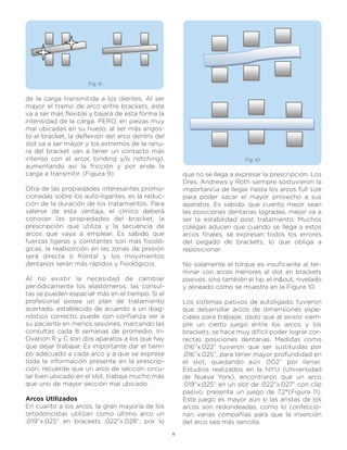Fig. 9


de la carga transmitida a los dientes. Al ser
mayor el tramo de arco entre brackets, éste
va a ser más flexible y bajará de esta forma la
intensidad de la carga. PERO, en piezas muy
mal ubicadas en su hueso, al ser más angos-
to el bracket, la deflexión del arco dentro del
slot va a ser mayor y los extremos de la ranu-
ra del bracket van a tener un contacto más
intenso con el arco( binding y/o notching),                                 Fig. 10
aumentando así la fricción y por ende la
carga a transmitir. (Figura 9)                        que no se llega a expresar la prescripción. Los
                                                      Dres. Andrews y Roth siempre sostuvieron la
Otra de las propiedades interesantes promo-           importancia de llegar hasta los arcos full size
cionadas sobre los auto-ligantes, es la reduc-        para poder sacar el mayor provecho a sus
ción de la duración de los tratamientos. Para         aparatos. Es sabido, que cuanto mejor sean
valerse de esta ventaja, el clínico deberá            las posiciones dentarias logradas, mejor va a
conocer las propiedades del bracket, la               ser la estabilidad post tratamiento. Muchos
prescripción que utiliza y la secuencia de            colegas aducen que cuando se llega a estos
arcos que vaya a emplear. Es sabido que               arcos finales, se expresan todos los errores
fuerzas ligeras y constantes son más fisioló-         del pegado de brackets, lo que obliga a
gicas, la reabsorción en las zonas de presión         reposicionar.
será directa o frontal y los movimientos
dentarios serán más rápidos y fisiológicos.           No solamente el torque es insuficiente al ter-
                                                      minar con arcos menores al slot en brackets
Al no existir la necesidad de cambiar                 pasivos, sino también el tip, el in&out, nivelado
periódicamente los elastómeros, las consul-           y alineado como se muestra en la Figura 10.
tas se pueden espaciar más en el tiempo. Si el
profesional posee un plan de tratamiento              Los sistemas pasivos de autoligado, tuvieron
acertado, establecido de acuerdo a un diag-           que desarrollar arcos de dimensiones espe-
nóstico correcto, puede con confianza ver a           ciales para trabajar, dado que al existir siem-
su paciente en menos sesiones, marcando las           pre un cierto juego entre los arcos y los
consultas cada 8 semanas de promedio. In-             brackets, se hace muy difícil poder lograr cor-
Ovation R y C son dos aparatos a los que hay          rectas posiciones dentarias. Medidas como
que dejar trabajar. Es importante dar el tiem-        .016”x.022” tuvieron que ser sustituidas por
po adecuado a cada arco y a que se exprese            .016”x.025”, para tener mayor profundidad en
toda la información presente en la prescrip-          el slot, quedando aún .002” por llenar.
ción, recuerde que un arco de sección circu-          Estudios realizados en la NYU (Universidad
lar bien ubicado en el slot, trabaja mucho más        de Nueva York), encontraron que un arco
que uno de mayor sección mal ubicado.                 .019”x.025” en un slot de .022”x.027” con clip
                                                      pasivo, presenta un juego de 7,2°(Figura 11).
Arcos Utilizados                                      Este juego es mayor aún si las aristas de los
En cuanto a los arcos, la gran mayoría de los         arcos son redondeadas, como lo confeccio-
ortodoncistas utilizan como último arco un            nan varias compañías para que la inserción
.019”x.025” en brackets .022”x.028”, por lo           del arco sea más sencilla.
                                                  6
 
