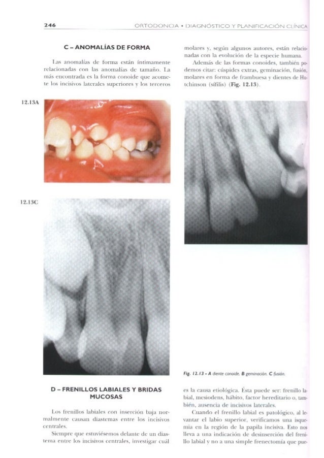 Ortodoncia Diagnostico Ortodoncia Diagnostico