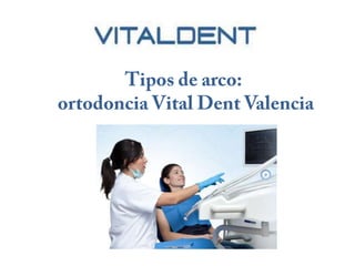 Ortodoncia Vital Dent Valencia: tipos de arco 