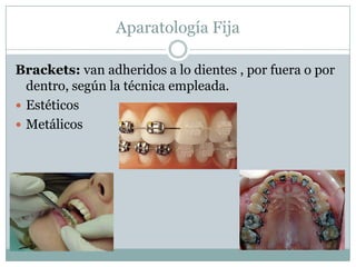 ORTODONCIA<br />La ortodoncia se ocupa de la alineación dentaria, y a partir de la  corrección de la mal posición recupera...