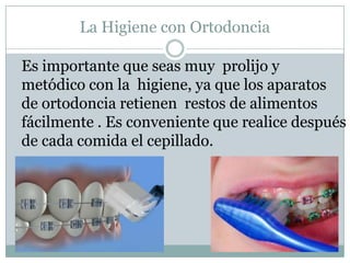 Convivir  con ortodoncia<br />Si algún arco, bracket o banda te está lastimando, puedes color cera de ortodoncias son de f...