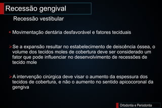 Recessão gengival
Ortodontia e Periodontia
 Movimentação dentária desfavorável e fatores teciduais
Se a expansão resultar no estabelecimento de deiscência óssea, o
volume dos tecidos moles de cobertura deve ser considerado um
fator que pode influenciar no desenvolvimento de recessões de
tecido mole
A intervenção cirúrgica deve visar o aumento da espessura dos
tecidos de cobertura, e não o aumento no sentido apicocoronal da
gengiva
Recessão vestibular
 
