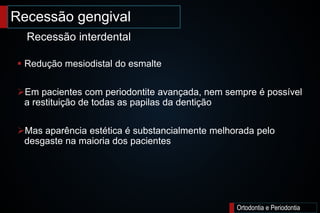 Ortodontia e Periodontia
 Redução mesiodistal do esmalte
Em pacientes com periodontite avançada, nem sempre é possível
a restituição de todas as papilas da dentição
Mas aparência estética é substancialmente melhorada pelo
desgaste na maioria dos pacientes
Recessão gengival
Recessão interdental
 