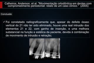 Calheiros, Anderson, et al. "Movimentação ortodôntica em dentes com
comprometimento periodontal: relato de um caso clínico." (2005)
 Foi constatado radiograficamente que, apesar do defeito ósseo
vertical do 21 não ter sido eliminado, houve uma real intrusão dos
elementos 21 e 22, com ganho de inserção, e uma melhora
substancial na função e estética da paciente, devida à combinação
de movimento de intrusão e retração;
Conclusão
 