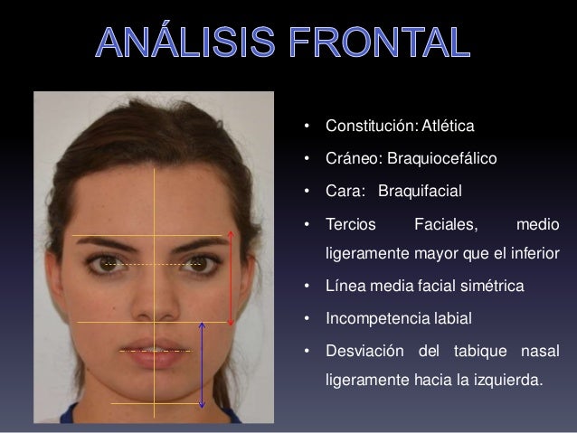 Diagnostico en ortodoncia. / Caso Clinico.