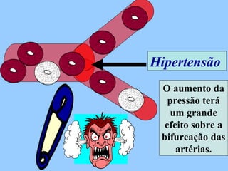 Hipertensão  O aumento da pressão terá um grande efeito sobre a bifurcação das artérias. 