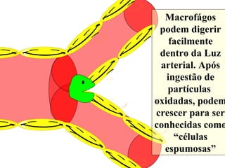 Macrofágos podem digerir facilmente dentro da Luz arterial. Após ingestão de partículas  oxidadas, podem crescer para ser conhecidas como “células espumosas” 