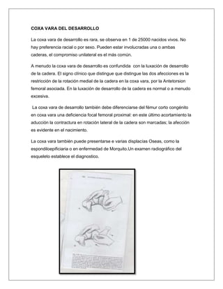 COXA VARA DEL DESARROLLO
La coxa vara de desarrollo es rara, se observa en 1 de 25000 nacidos vivos. No
hay preferencia racial o por sexo. Pueden estar involucradas una o ambas
caderas, el compromiso unilateral es el más común.
A menudo la coxa vara de desarrollo es confundida con la luxación de desarrollo
de la cadera. El signo clínico que distingue que distingue las dos afecciones es la
restricción de la rotación medial de la cadera en la coxa vara, por la Antetorsion
femoral asociada. En la luxación de desarrollo de la cadera es normal o a menudo
excesiva.
La coxa vara de desarrollo también debe diferenciarse del fémur corto congénito
en coxa vara una deficiencia focal femoral proximal: en este último acortamiento la
aducción la contractura en rotación lateral de la cadera son marcadas; la afección
es evidente en el nacimiento.
La coxa vara también puede presentarse e varias displacías Oseas, como la
espondiloepificiaria o en enfermedad de Morquito.Un examen radiográfico del
esqueleto establece el diagnostico.

 