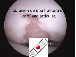 Curación de una fractura del
cartílago articular.

 