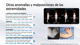 Focomelia Rx ortopedia en neonatos en neonatología.pptx