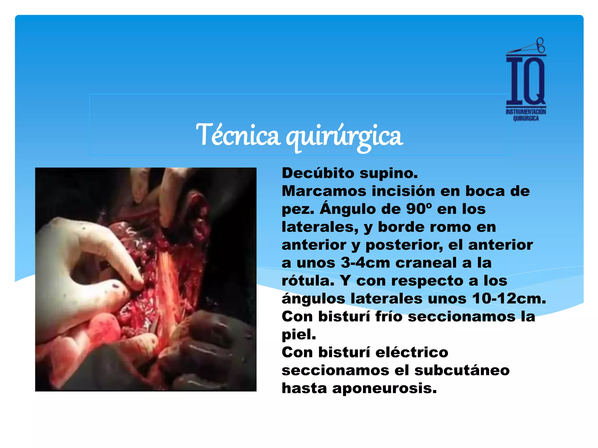 Ortopedia generalidades | PPTX