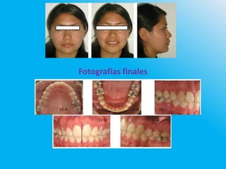 Fotografías finales
 