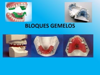 BLOQUES GEMELOS
 
