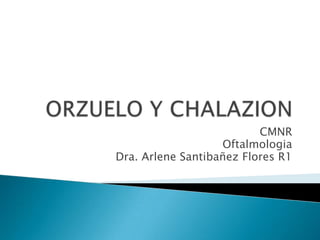 CMNR
                   Oftalmologia
Dra. Arlene Santibañez Flores R1
 