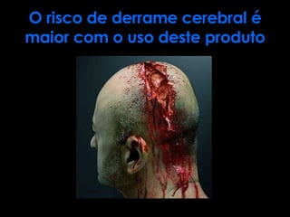 O risco de derrame cerebral é maior com o uso deste produto 