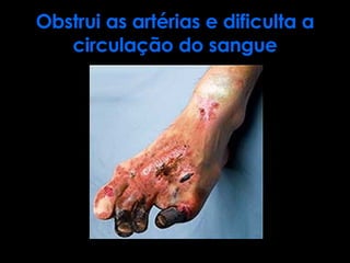 Obstrui as artérias e dificulta a circulação do sangue 