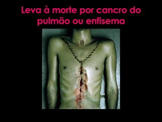 Leva à morte por cancro do pulmão ou enfisema 