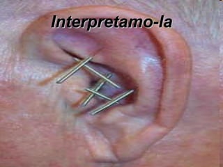 Interpretamo-la 