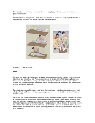 Quando o terreno for plano, conduzir a vítima com os pés para diante, preservando a cabeça de
possíveis choques.
Quando o terreno for íngreme, a maca deve ser mantida de preferência em posição horizontal, a
menos que o socorrista não tenha condições físicas de fazê-lo.
CORPOS ESTRANHOS
Olho
Os olhos são áreas corpóreas muito sensíveis, sendo necessário muito cuidado com todo tipo de
ocorrência que possa lesá-los. Por isso, a existência de corpos estranhos nesta região deve ser
tratada com muita cautela e atenção, fazendo uso de algumas técnicas muito simples. Estas,
quando não conseguem retirar o elemento lesivo, buscam estabiliza-lo de forma que ele não possa
agravar ainda mais a situação.
Para o uso correto das técnicas é importante diferenciar qual a relação entre estes corpos e o(s)
olho(s) afetado(s). Deste ponto de vista, os corpos estranhos no olho podem ser classificados em
móveis e fixos.
Os móveis são principalmente ciscos e cílios, mas podem ser também líquidos como ácidos, bases
e outras substâncias químicas ou mesmo seres vivos como insetos. Assim sendo, a melhor forma
para sua retirada é a lavagem com água corrente no sentido de medial para lateral (do nariz para
orelha) por aproximadamente 15 minutos. Se o corpo estranho estiver debaixo da pálpebra, poderá
ser utilizada a manobra de eversão palpebral a qual exporá a mucosa da mesma. Com a mucosa
exposta será feita a tentativa de pescar este corpo estranho com uma gaze umidecida em água ou
soro fisiológico.
 