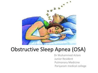 Obstructive Sleep Apnea (OSA)
Dr Muhammed Aslam
Junior Resident
Pulmonary Medicine
Pariyaram medical college
 