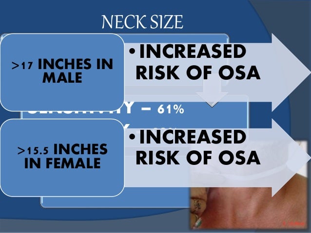 obstructive sleep apnea neck size sleep apnea