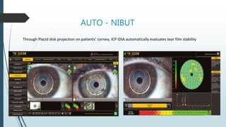 AUTO - NIBUT
Through Placid disk projection on patients’ cornea, ICP OSA automatically evaluates tear film stability
 