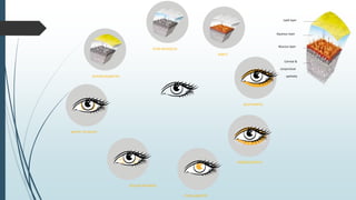 OCULAR REDNESS
WHITE TO WHITE
PUPILLOMETRY
INTERFEROMETRY
TEAR MENISCUS
NIBUT
BLEPHARITIS
MEIBOGRAPHY
Lipid layer
Aqueous layer
Mucous layer
Corneal &
conjunctival
epithelia
 