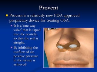 Provent Provent is a relatively new FDA approved proprietary device for treating OSA.  It is a 'one-way  valve' that is taped  into the nostrils,  so that the seal is  airtight.  By inhibiting the  outflow of air,  positive pressure  in the airway is  achieved 