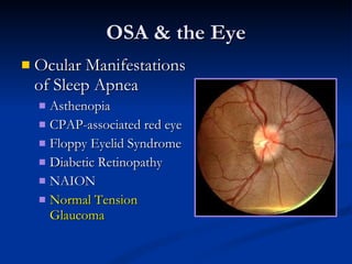 OSA & the Eye Ocular Manifestations of Sleep Apnea Asthenopia CPAP-associated red eye Floppy Eyelid Syndrome Diabetic Retinopathy NAION Normal Tension Glaucoma 