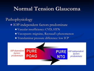 Normal Tension Glaucoma Pathophysiology IOP-independent factors predominate Vascular insufficiency: CVD, HTN Vasospasm: migraine, Raynaud's phenomenon  Translaminar pressure difference: low ICP 