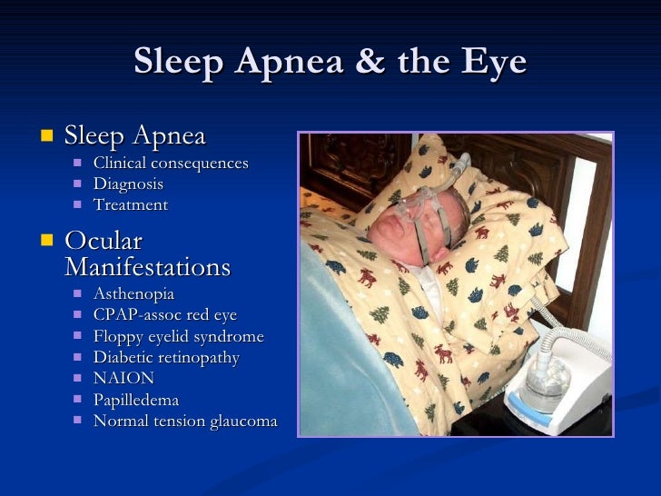 Sleep Apnea & The Eye 2011