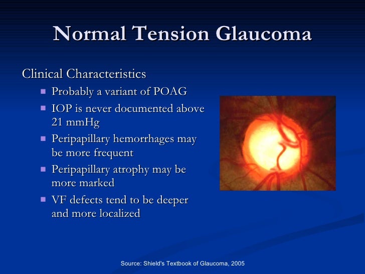 Sleep Apnea & The Eye 2011