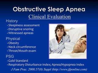 Obstructive Sleep Apnea
                  Clinical Evaluation
History
• Sleepiness assessment
• Disruptive snoring
• Witnessed apneas

Physical
• Obesity
• Neck circumference
• Throat/Mouth exam

PSG
• Gold Standard
• Respiratory DisturbanceIndex; Apnea/Hypopnea Index
   J Fam Prac. 2008;57(8) Suppl (http://www.jfponline.com)
 