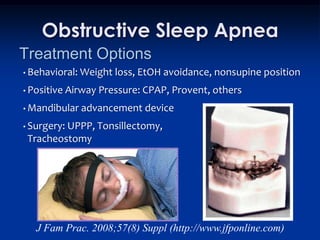 Obstructive Sleep Apnea
Treatment Options
• Behavioral: Weight   loss, EtOH avoidance, nonsupine position
• Positive Airway   Pressure: CPAP, Provent, others
• Mandibular   advancement device
• Surgery:
         UPPP, Tonsillectomy,
 Tracheostomy




   J Fam Prac. 2008;57(8) Suppl (http://www.jfponline.com)
 