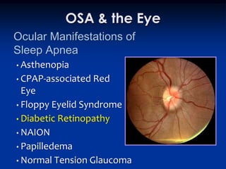 OSA & the Eye
Ocular Manifestations of
Sleep Apnea
• Asthenopia
• CPAP-associated   Red
  Eye
• Floppy Eyelid Syndrome
• Diabetic Retinopathy
• NAION
• Papilledema
• Normal Tension Glaucoma
 