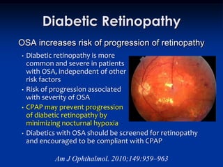 Diabetic Retinopathy
OSA increases risk of progression of retinopathy
•   Diabetic retinopathy is more
    common and severe in patients
    with OSA, independent of other
    risk factors
•   Risk of progression associated
    with severity of OSA
•   CPAP may prevent progression
    of diabetic retinopathy by
    minimizing nocturnal hypoxia
•   Diabetics with OSA should be screened for retinopathy
    and encouraged to be compliant with CPAP

            Am J Ophthalmol. 2010;149:959–963
 