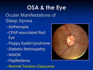 OSA & the Eye
Ocular Manifestations of
Sleep Apnea
• Asthenopia
• CPAP-associated   Red
  Eye
• Floppy Eyelid Syndrome
• Diabetic Retinopathy
• NAION
• Papilledema
• Normal Tension Glaucoma
 