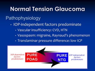 Normal Tension Glaucoma
Pathophysiology
  •   IOP-independent factors predominate
      •   Vascular insufficiency: CVD, HTN
      •   Vasospasm: migraine, Raynaud's phenomenon
      •   Translaminar pressure difference: low ICP
 