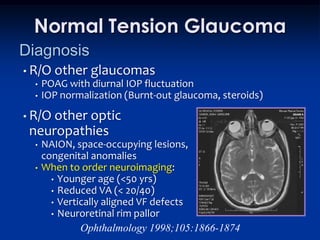 Normal Tension Glaucoma
Diagnosis
• R/O   other glaucomas
  •   POAG with diurnal IOP fluctuation
  •   IOP normalization (Burnt-out glaucoma, steroids)
• R/Oother optic
 neuropathies
  •   NAION, space-occupying lesions,
      congenital anomalies
  •   When to order neuroimaging:
        • Younger age (<50 yrs)
        • Reduced VA (< 20/40)
        • Vertically aligned VF defects
        • Neuroretinal rim pallor
               Ophthalmology 1998;105:1866-1874
 