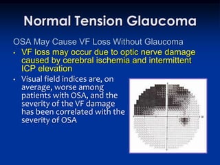 Normal Tension Glaucoma
OSA May Cause VF Loss Without Glaucoma
• VF loss may occur due to optic nerve damage
  caused by cerebral ischemia and intermittent
  ICP elevation
• Visual field indices are, on
  average, worse among
  patients with OSA, and the
  severity of the VF damage
  has been correlated with the
  severity of OSA
 