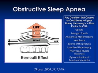 Obstructive Sleep Apnea
                             Any Condition that Causes
                               or Contributes to Upper
                             Airway Narrowing is a Risk
                                   Factor for OSA
                                       Obesity
                                   Enlarged Tonsils
                              Anatomical Malformations
                                     Neoplasms
                                Edema of the pharynx
                                Lymphoid Hypertrophy
                                  Pharyngeal Muscle
                                      Weakness
                                  Dyscoordination of
                                 Respiratory Muscles


      Thorax 2004;59:73-78
 