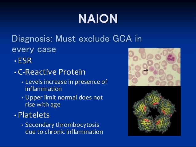 Cialis naion