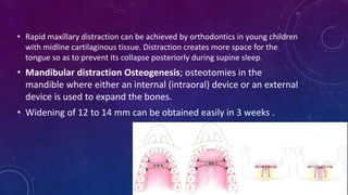 • Rapid maxillary distraction can be achieved by orthodontics in young children
with midline cartilaginous tissue. Distraction creates more space for the
tongue so as to prevent its collapse posteriorly during supine sleep.
• Mandibular distraction Osteogenesis; osteotomies in the
mandible where either an internal (intraoral) device or an external
device is used to expand the bones.
• Widening of 12 to 14 mm can be obtained easily in 3 weeks .
 