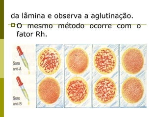 da lâmina e observa a aglutinação.
 O mesmo método ocorre com o
fator Rh.
 
