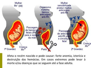 Afeta o recém nascido e pode causar: forte anemia, icterícia e
destruição das hemácias. Em casos extremos pode levar à
morte e/ou doenças que se seguem até a fase adulta.
 