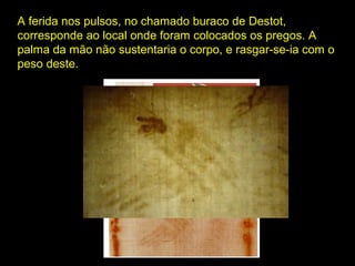 A ferida nos pulsos, no chamado buraco de Destot,
corresponde ao local onde foram colocados os pregos. A
palma da mão não sustentaria o corpo, e rasgar-se-ia com o
peso deste.

 